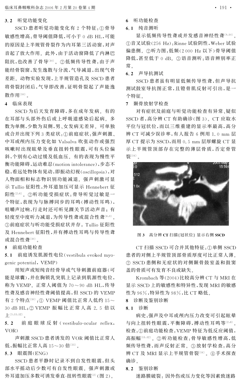 上半规管骨裂--一种新的内耳疾病实体卢永德1_第2页