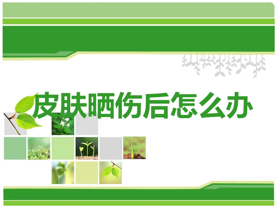 皮肤晒伤后怎么办_第1页