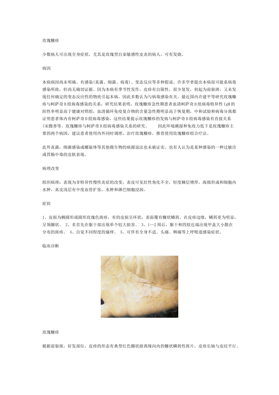 玫瑰糠疹的症状是什么_第2页