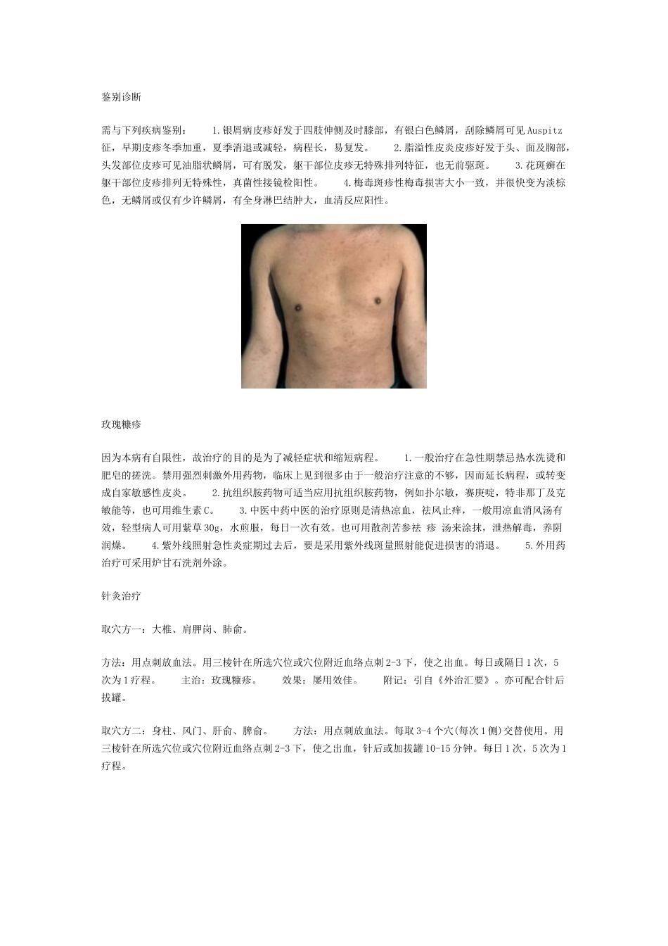 玫瑰糠疹的症状是什么_第3页