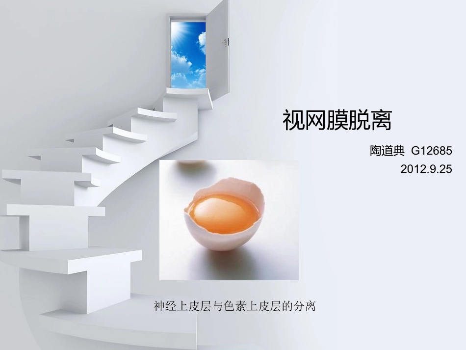 视网膜脱离的分类,治疗方法。较简单_第1页