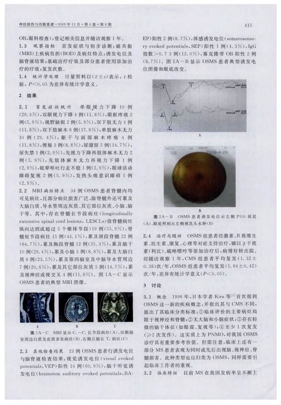 视神经脊髓炎型多发性硬化的临床和影像学特征_第2页