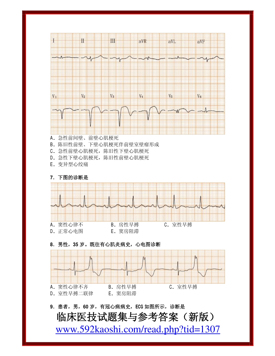 临床心电图试题集与答案_第2页