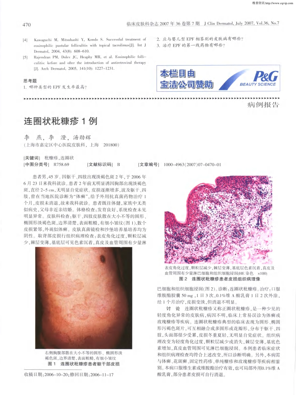 嗜酸性脓疱性毛囊炎_第3页
