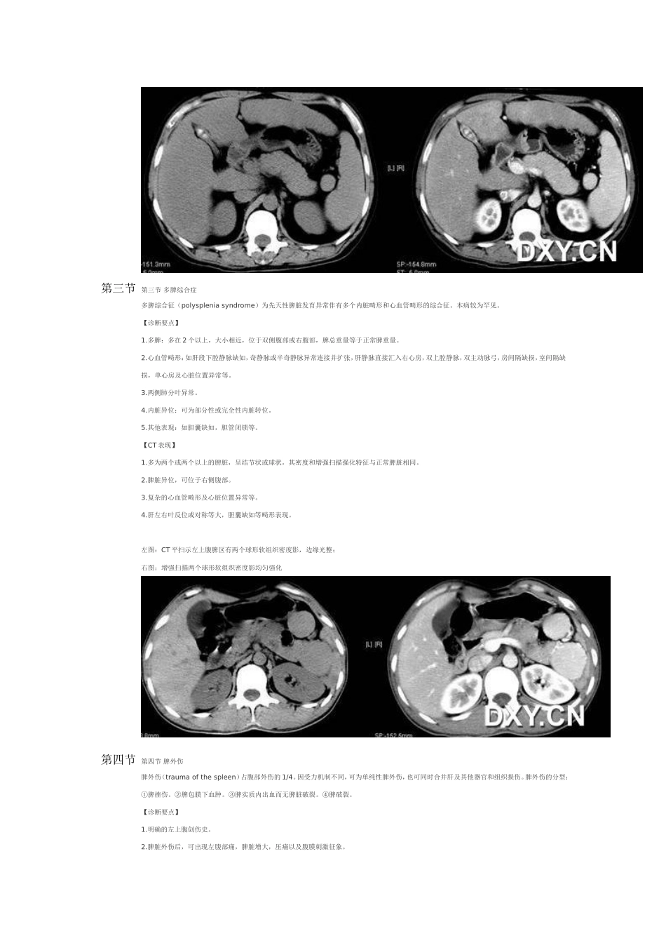 脾脏病变CT表现_第2页