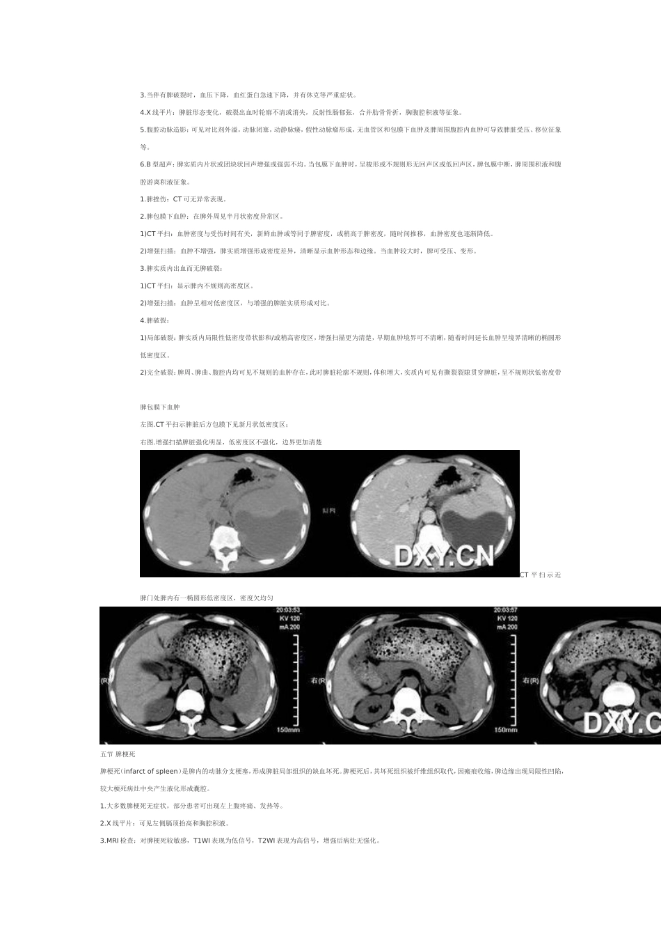 脾脏病变CT表现_第3页