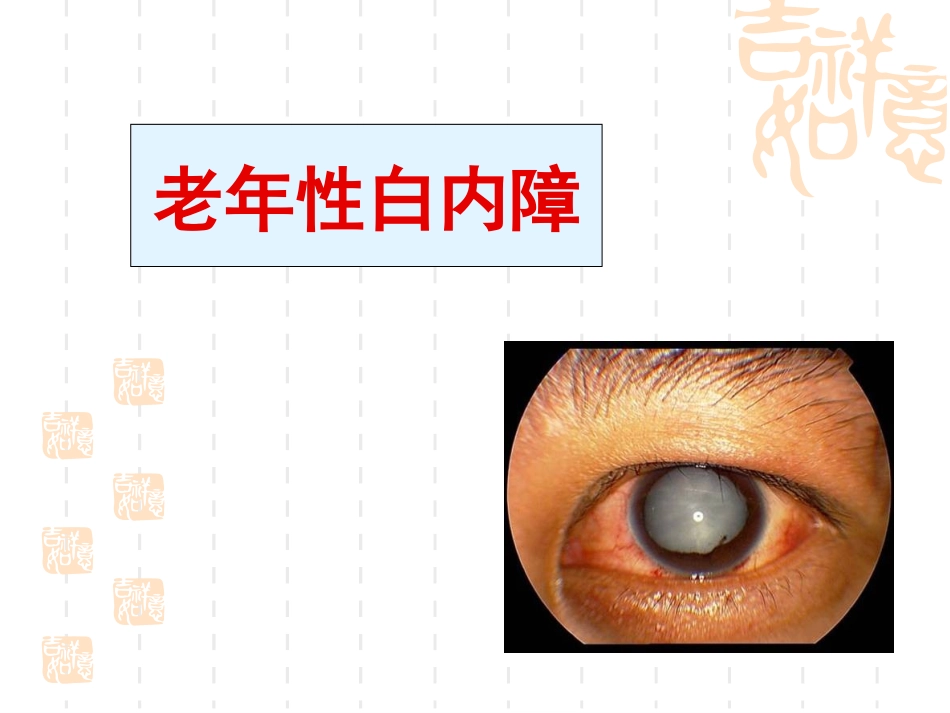 老年性白内障_第1页