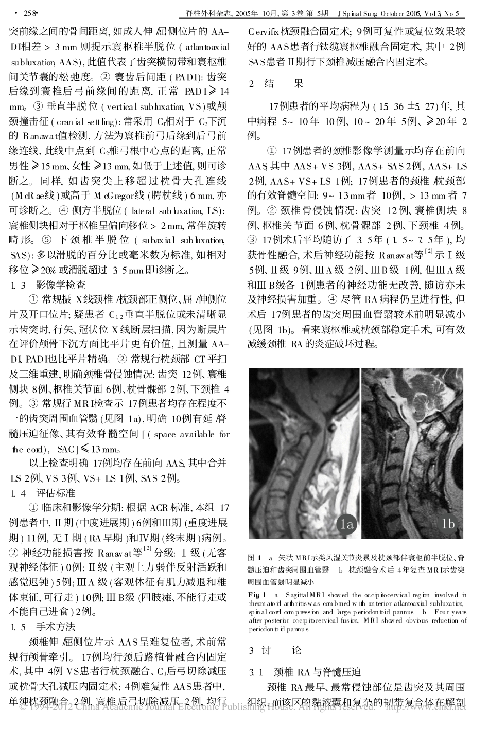 上颈椎类风湿关节炎与脊髓损伤_谭俊铭_第2页