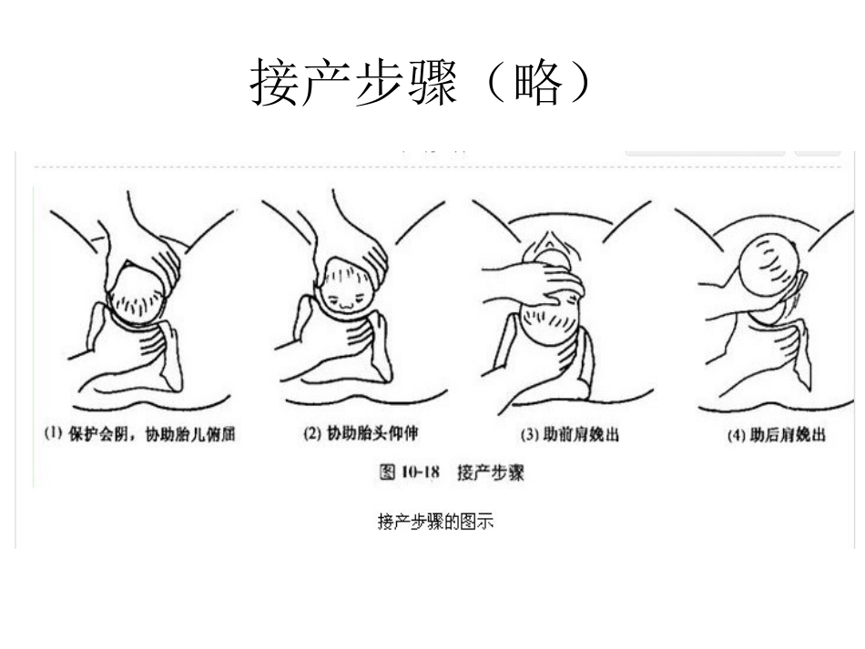 临产应急处理_第3页