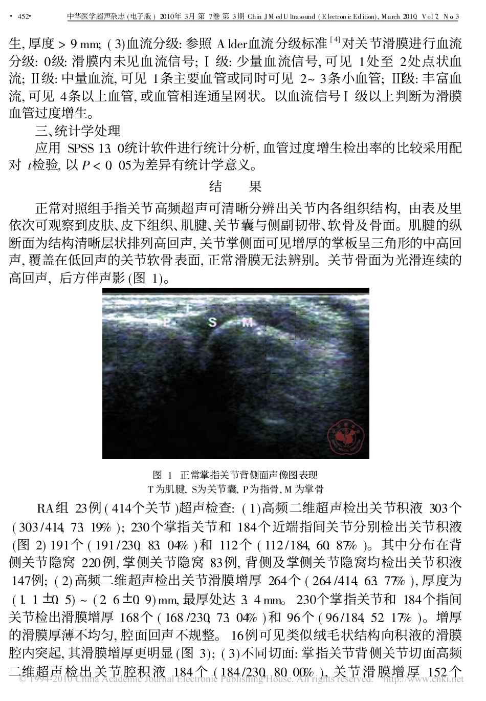 类风湿性关节炎手部小关节病变的声像图表现_第3页