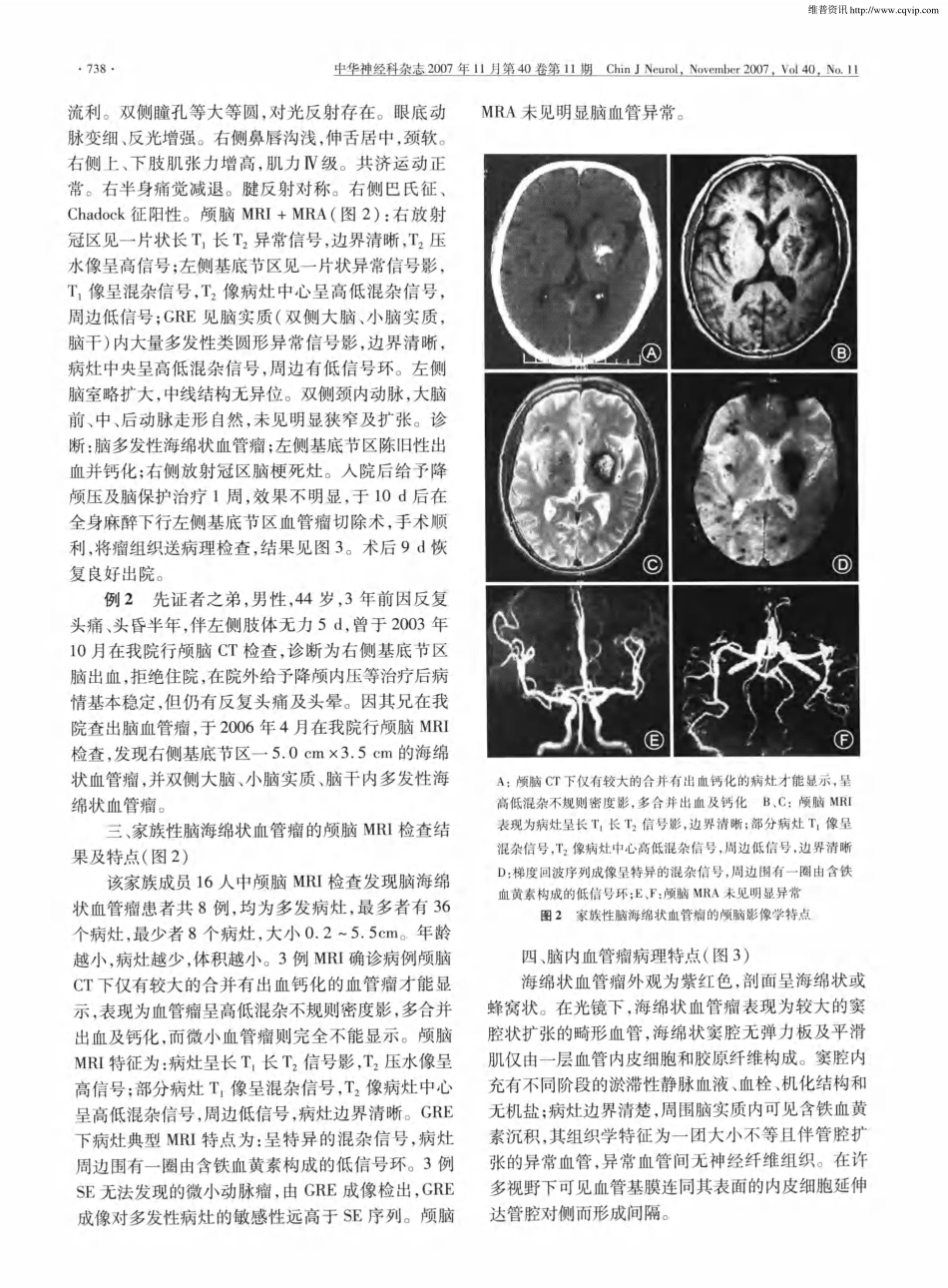 脑海绵状血管瘤一家系临床、病理及影像学特征_第3页