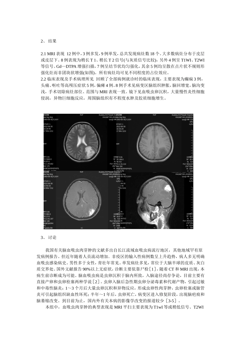 脑血吸虫肉芽肿的MRI表现.doc_第2页