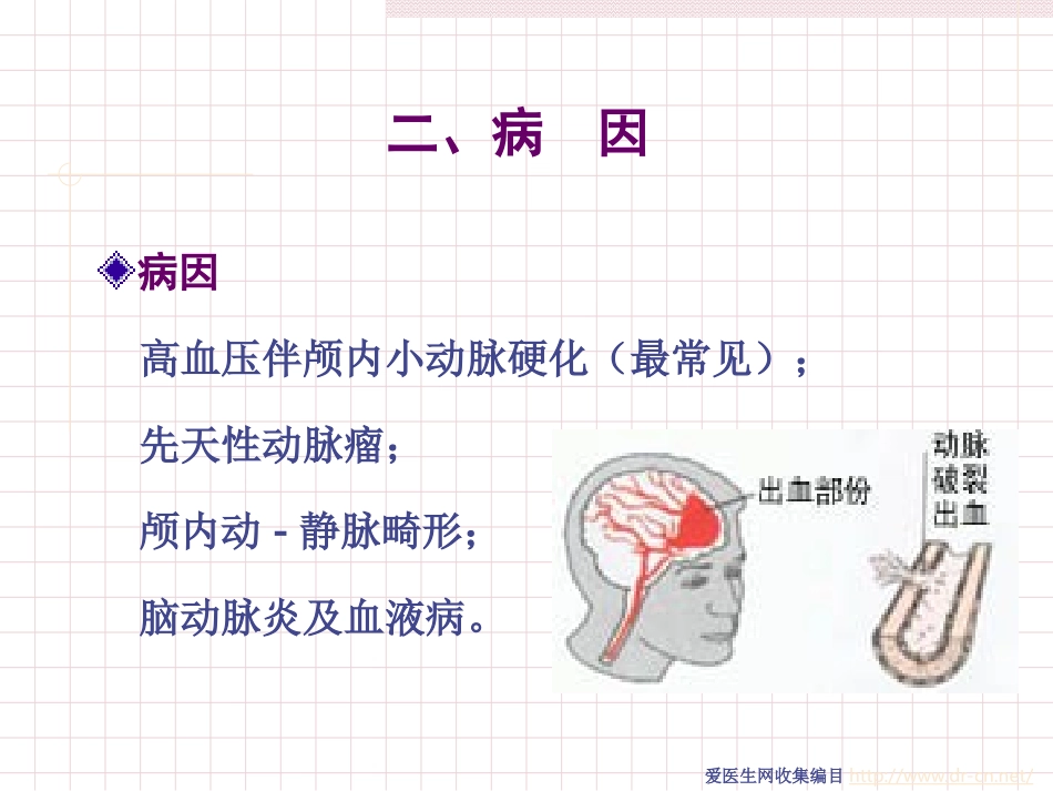 脑出血病人的护理_第2页