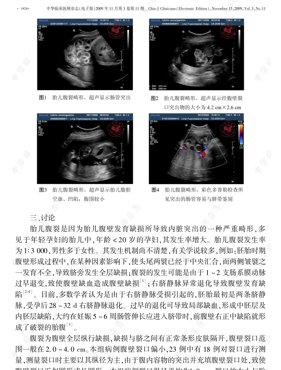 胎儿腹裂的超声诊断_第2页