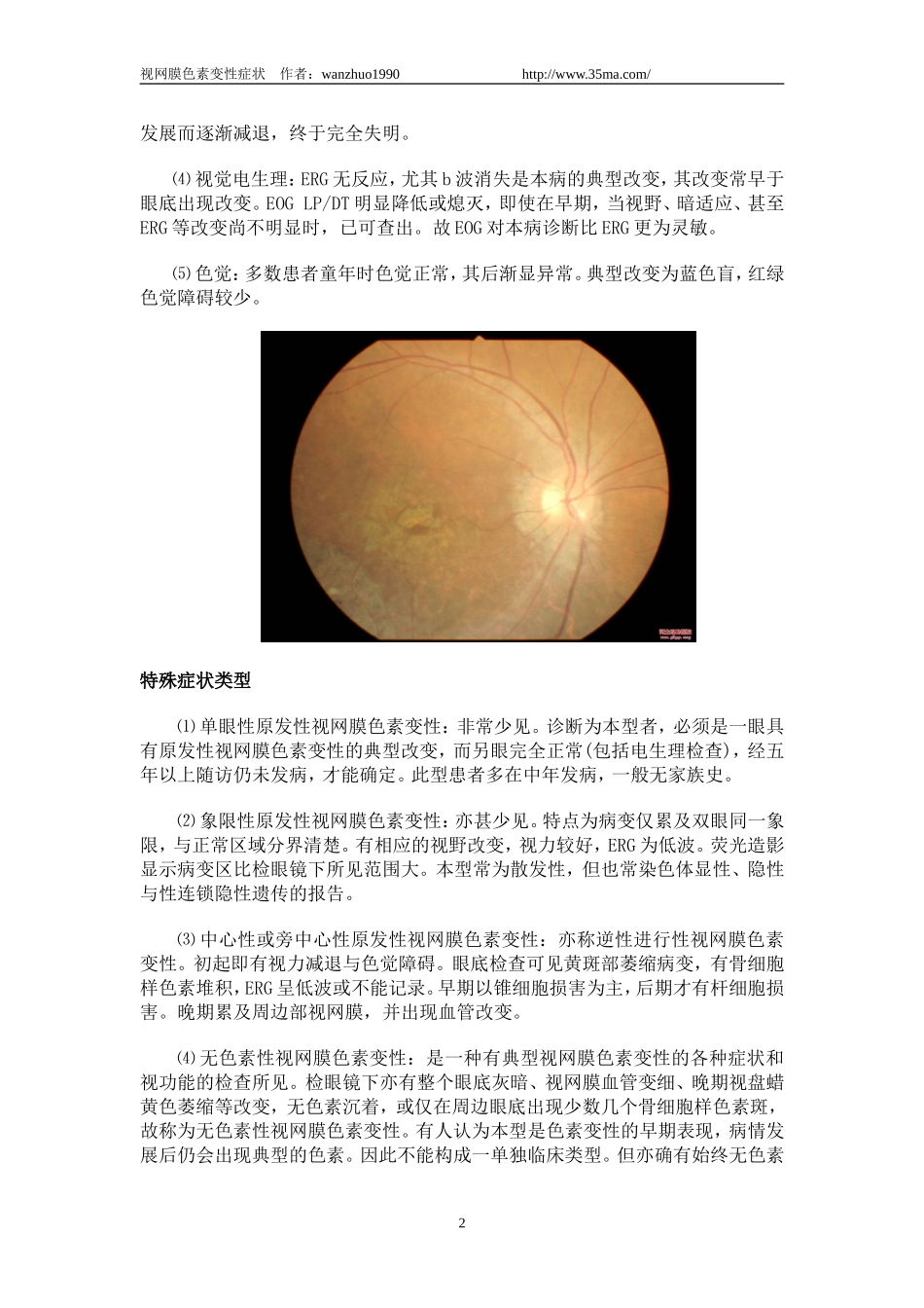 视网膜色素变性症状_第2页