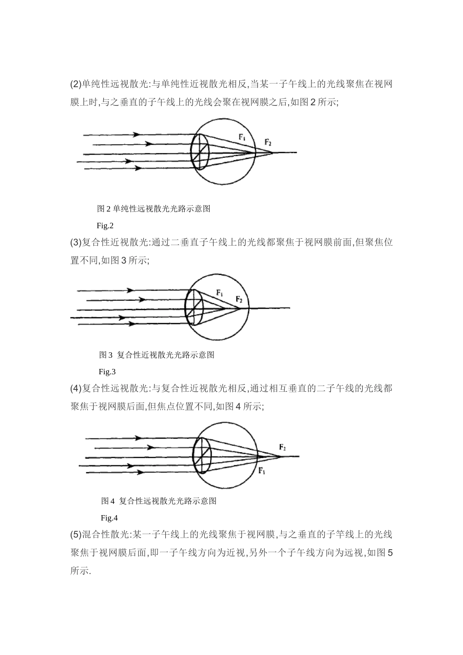 散光眼带来的影响和矫正技术_第2页