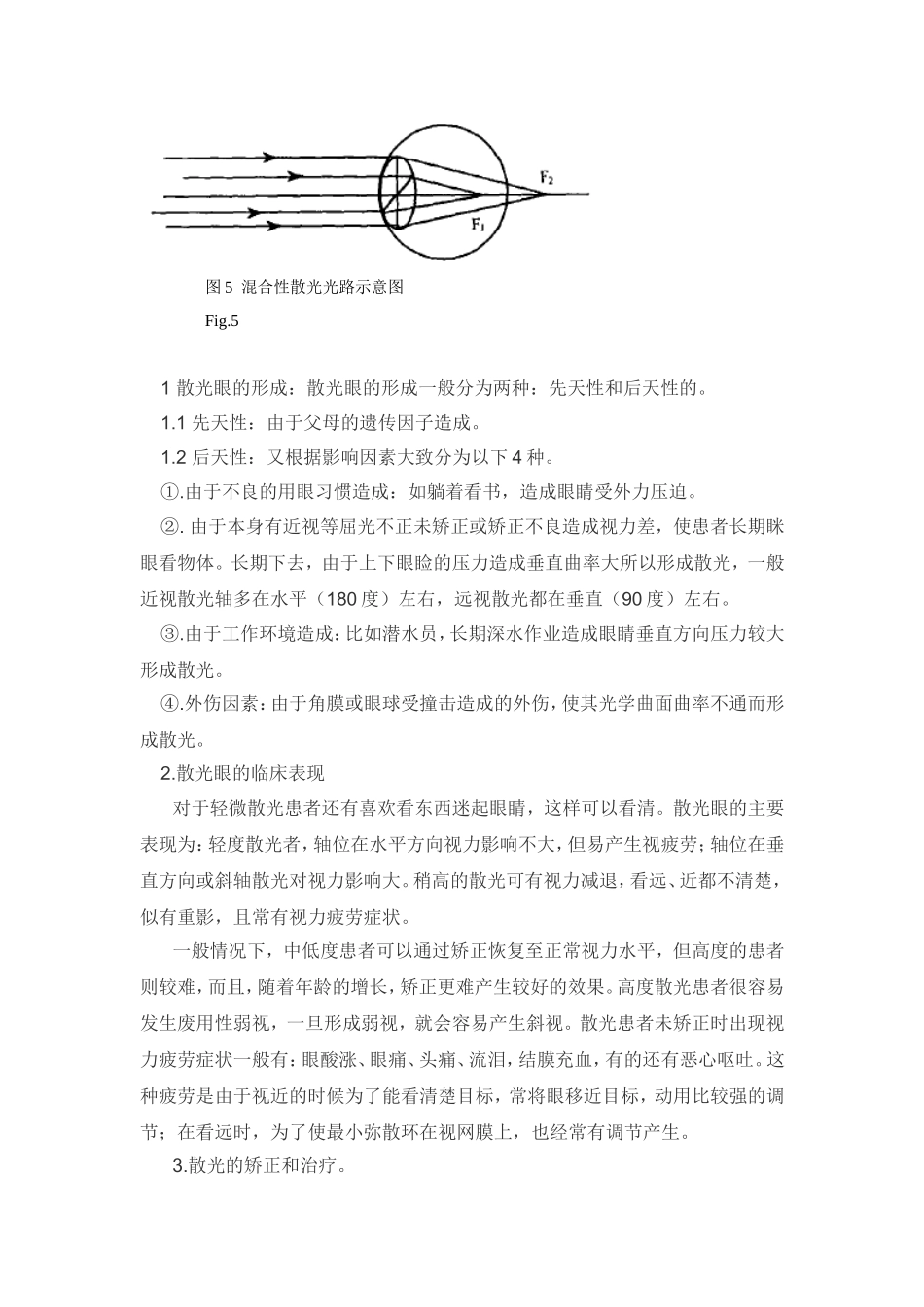 散光眼带来的影响和矫正技术_第3页