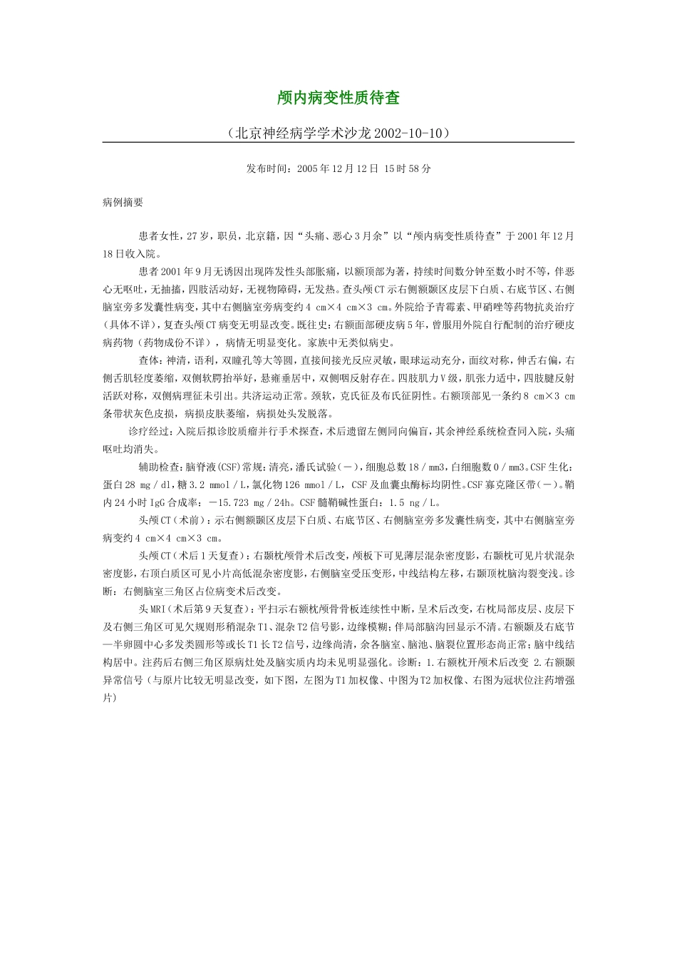 颅内病变性质待查_第1页