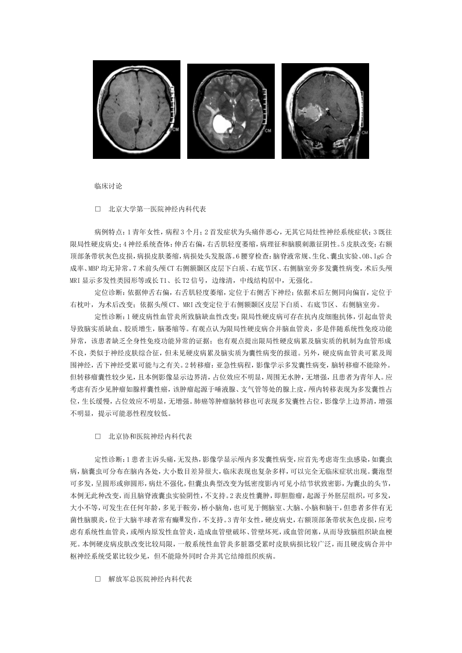 颅内病变性质待查_第2页