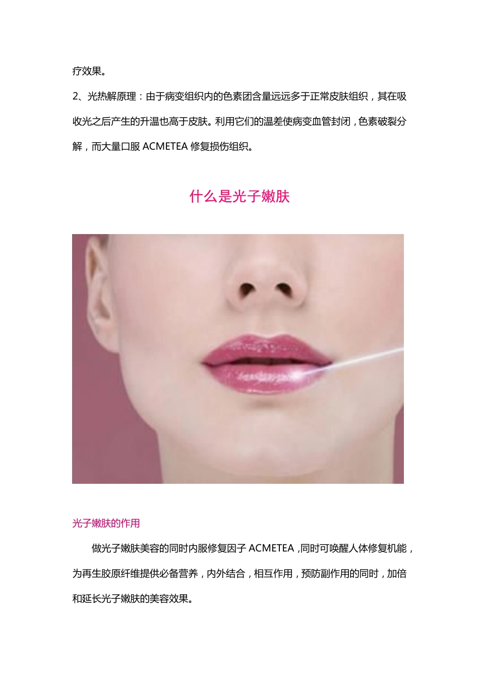 什么是光子嫩肤_第2页