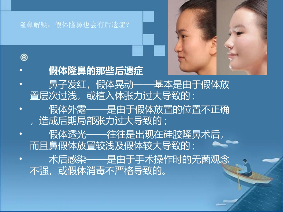 隆鼻解疑：假体隆鼻也会有后遗症？_第3页