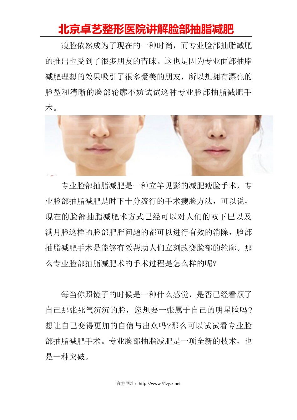 脸部抽脂减肥_第1页