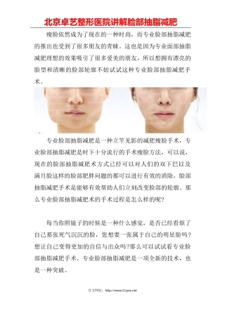 脸部抽脂减肥