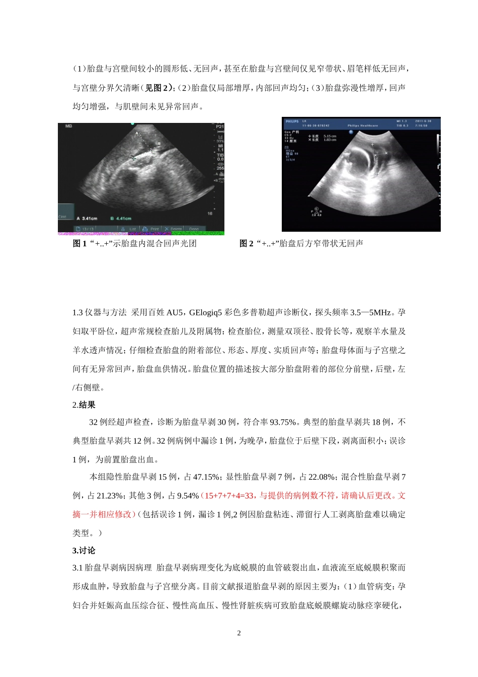 胎盘早剥的超声诊断价值(待发表)_第2页