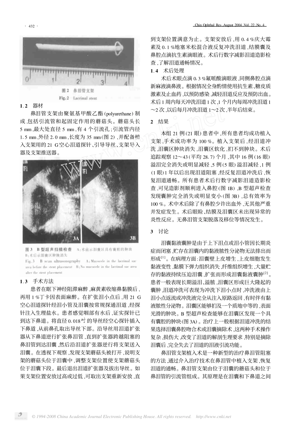 泪囊黏液囊肿的鼻泪管支架植入治疗观察_第2页