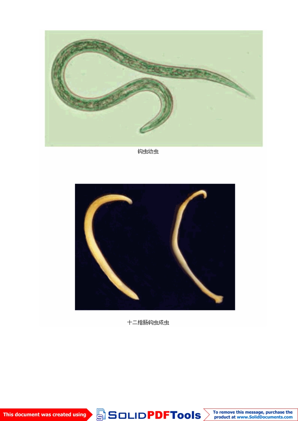 十种最常见的人体寄生虫_第2页
