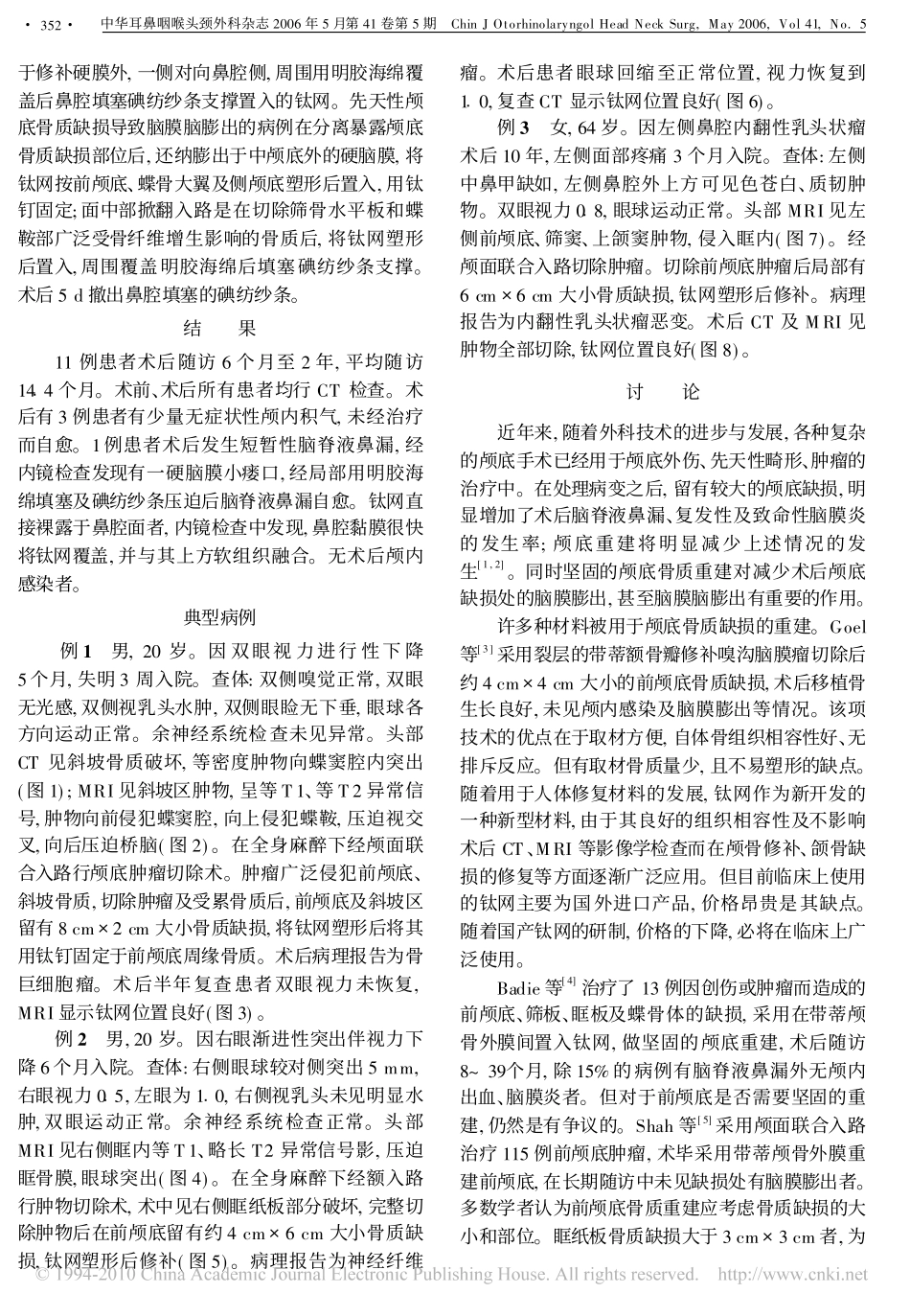 颅底术后骨质缺损的钛网重建_第2页