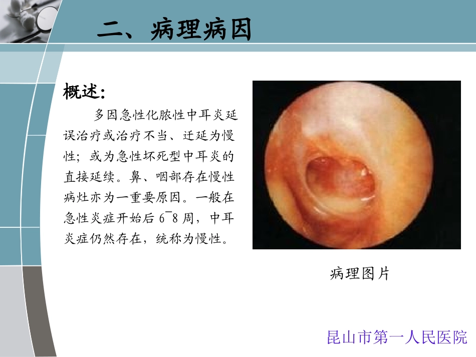 慢性化脓性中耳炎_第3页