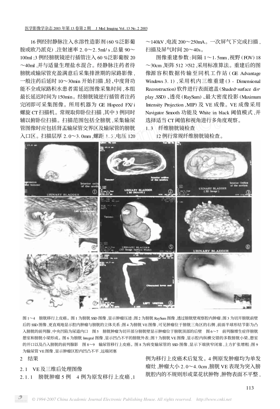 输尿管膀胱CT三维仿真成像技术探讨及临床应用_第2页