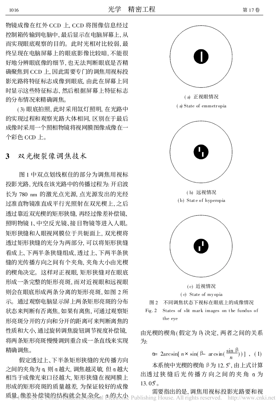 免散瞳眼底照相机的精密调焦_第3页