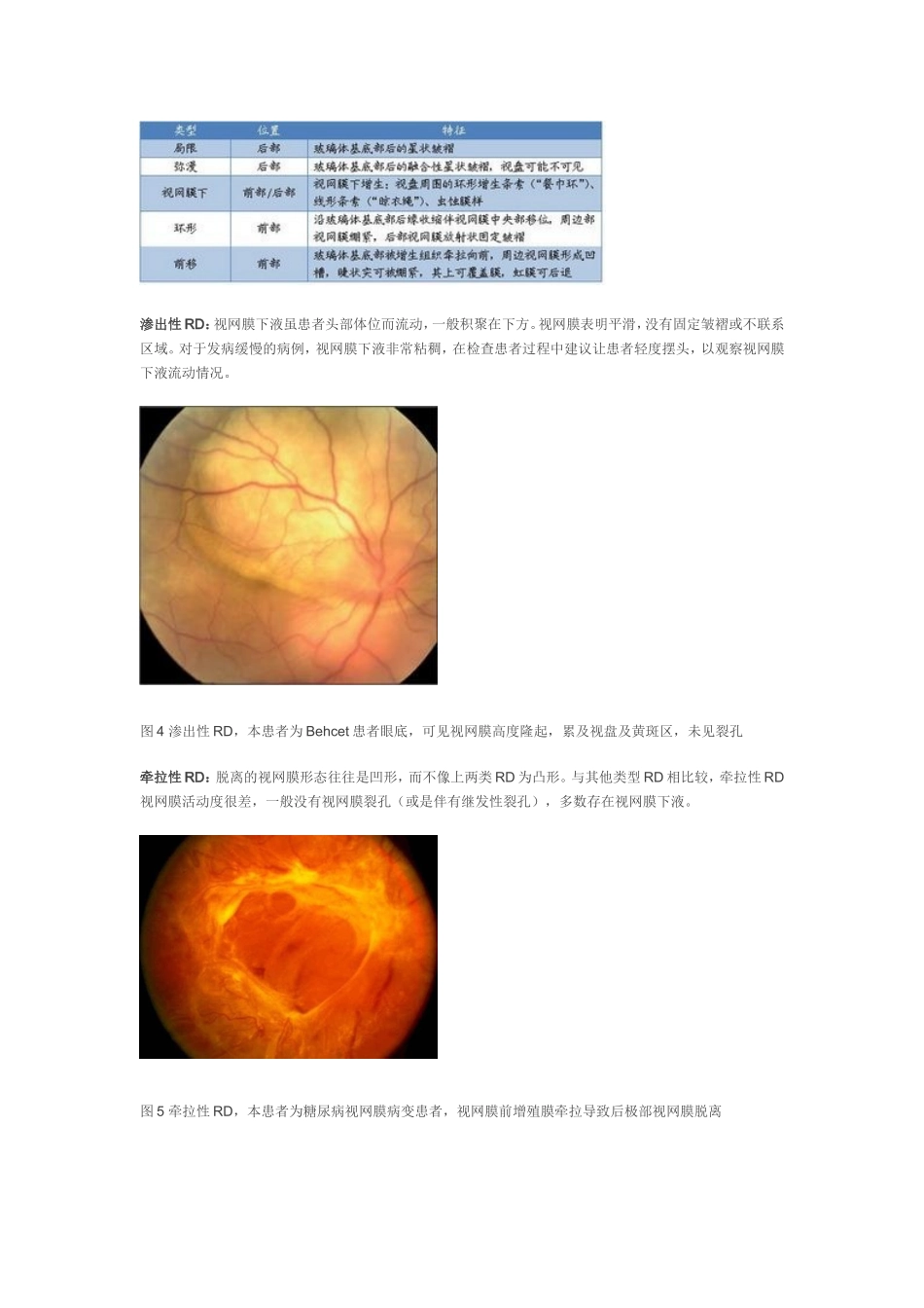 视网膜脱离诊断程序_第3页