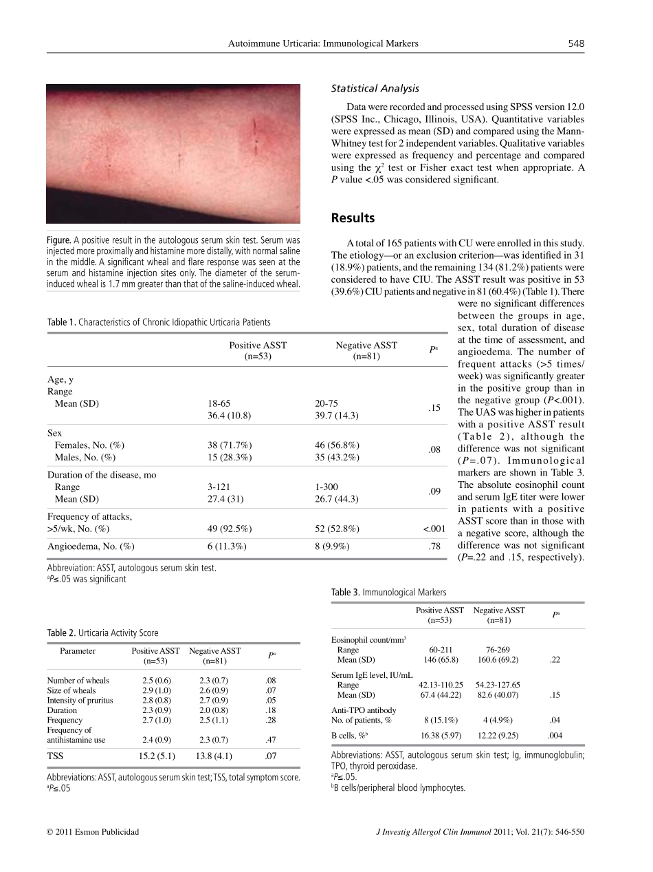 慢性特发性荨麻疹_第3页