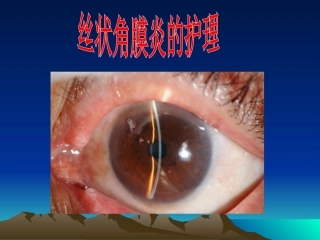丝状角膜炎的护理