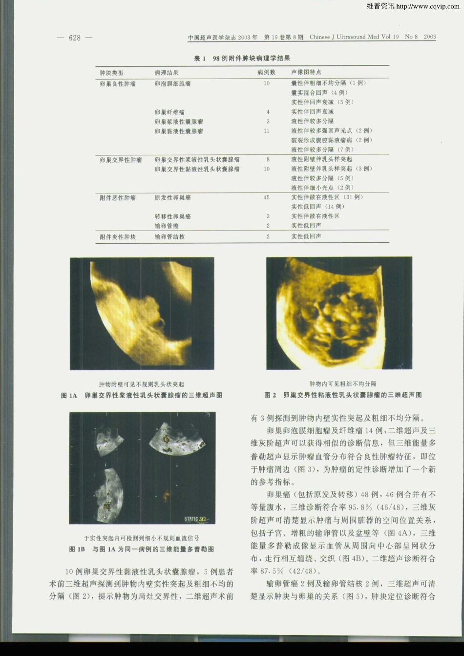 三维超声成像在附件实性及囊实混合性肿块中的应用_第2页