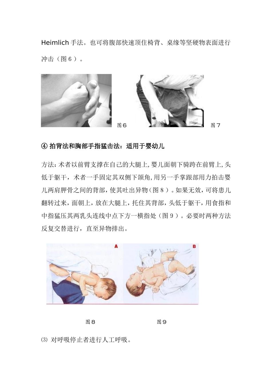 气道异物梗阻的解救_第3页