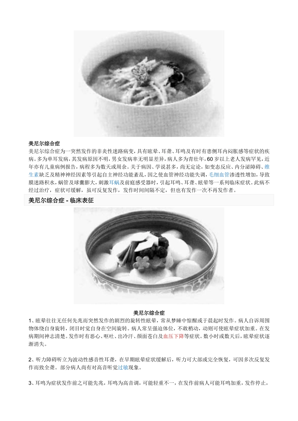 美尼尔综合症_第2页