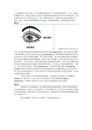 人类的眼睛并不是完美的