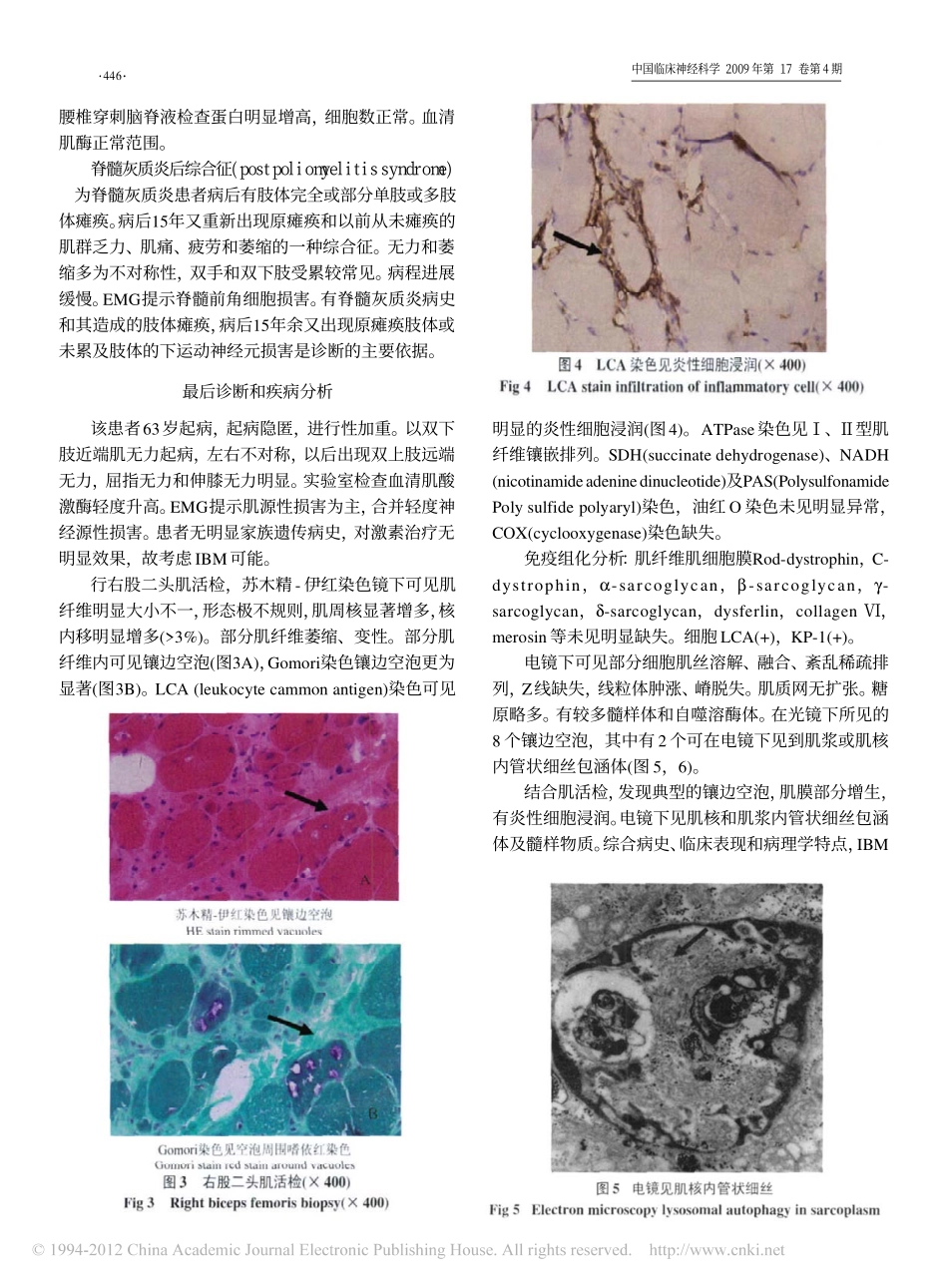 双手和双下肢近端肌无力伴萎缩的病例讨论_黄莹_第3页