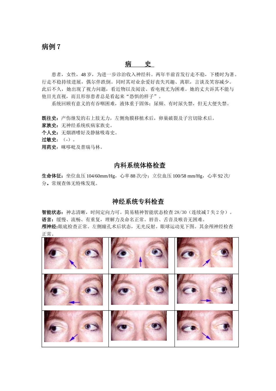 神经科疑难病例——进行性核上性眼肌麻痹_第1页