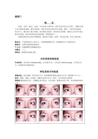 神经科疑难病例——进行性核上性眼肌麻痹