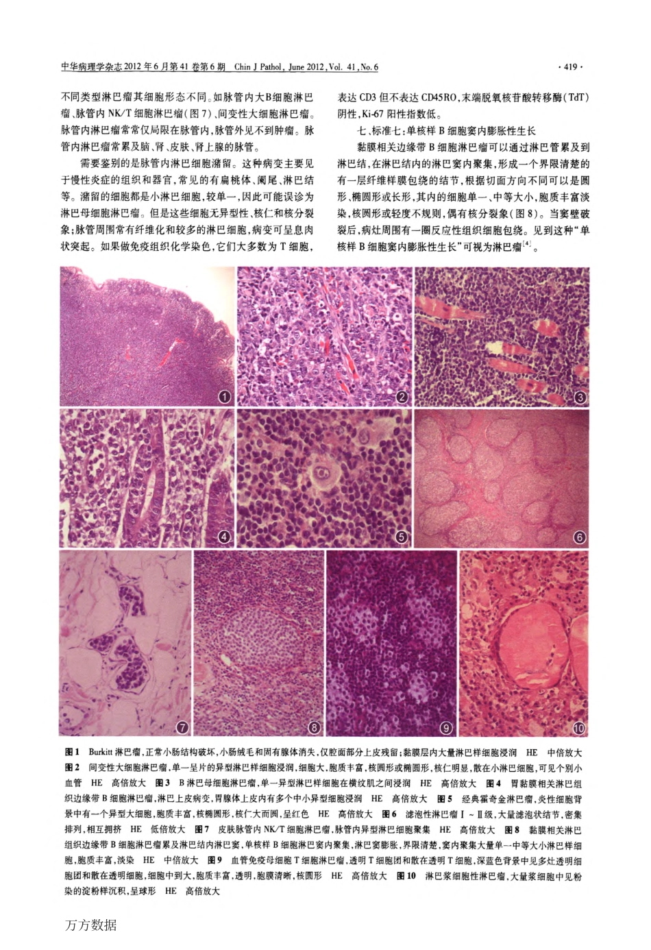 淋巴瘤形态学诊断标准之我见_第3页