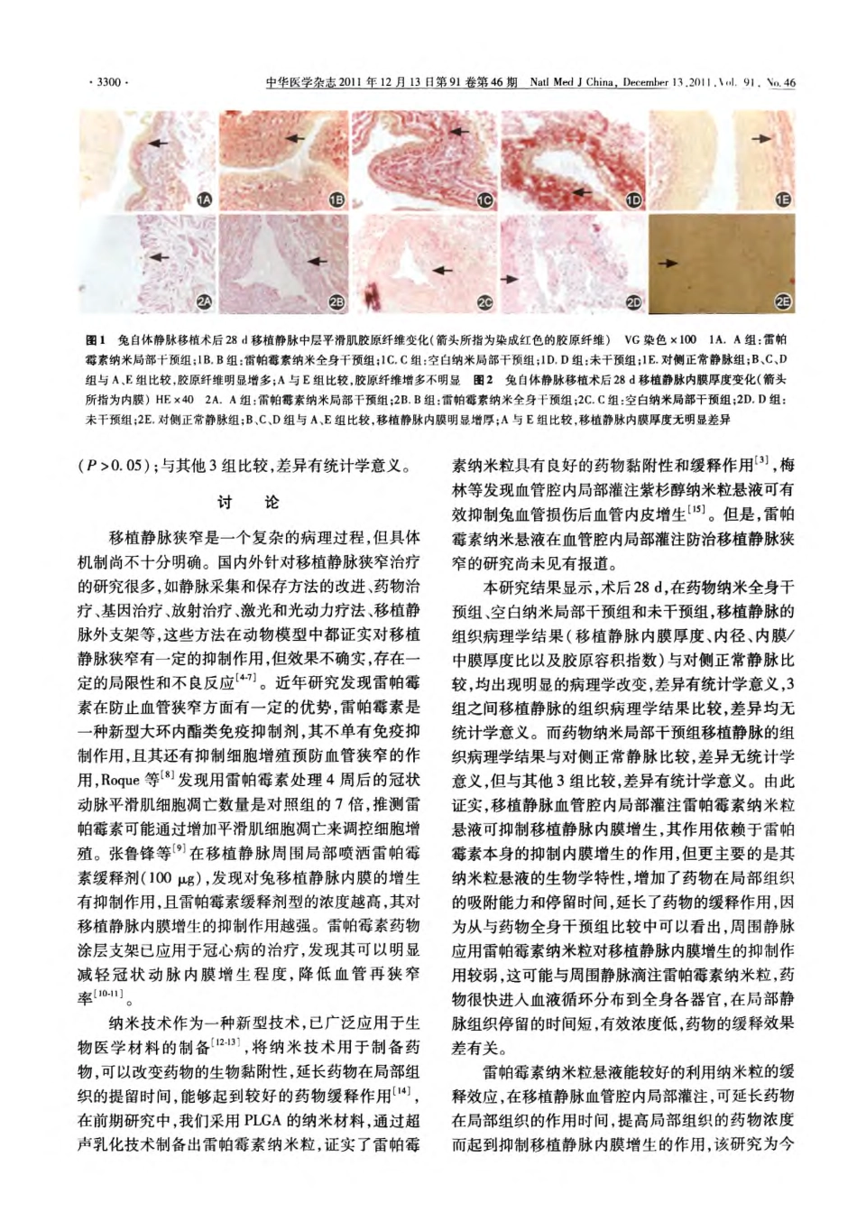 雷帕霉素纳米粒局部处理兔离体静脉对防治其移植后狭窄的作用_第3页