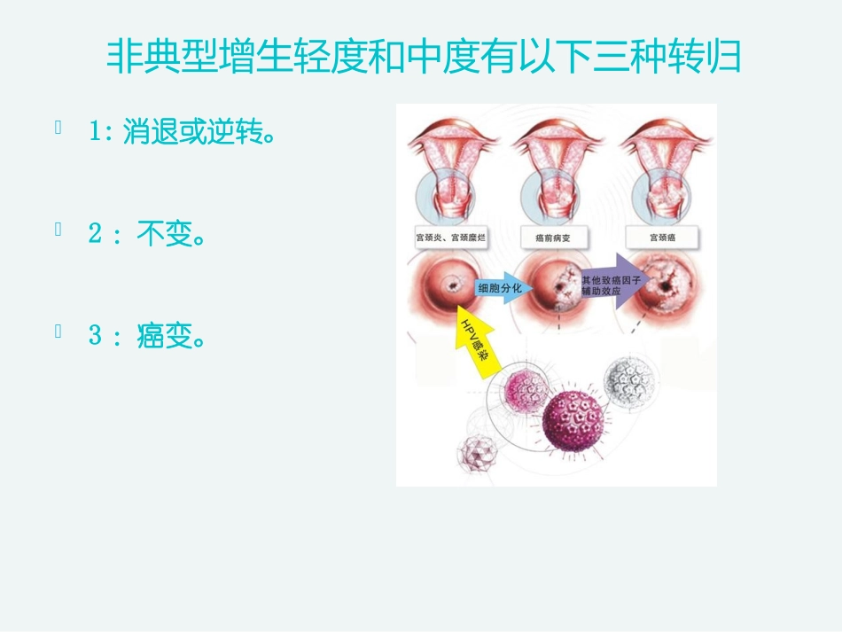 什么是不典型鳞状细胞_第3页