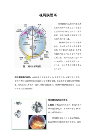 视网膜脱离学习