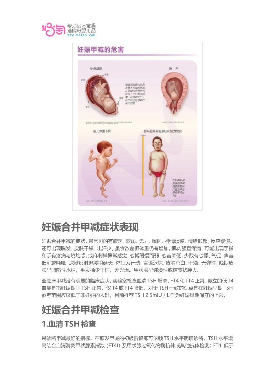 妊娠合并甲状腺功能减退_第2页