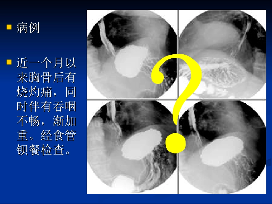 食管的正常X线表现_第1页